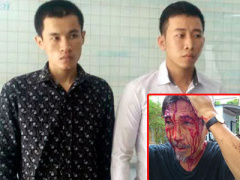 Ảnh bìa bài viết 333419