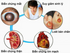 Ảnh bìa bài viết 336246