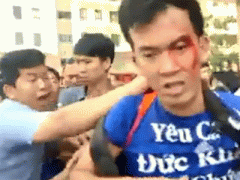 Ảnh bìa bài viết 336831