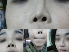 Ảnh bìa bài viết 338843