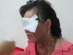Ảnh bìa bài viết 338929