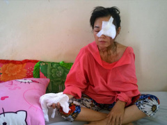 Ảnh bìa bài viết 339267