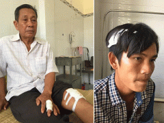 Ảnh bìa bài viết 340565