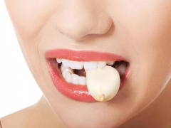 Ảnh bìa bài viết 344203