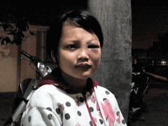 Ảnh bìa bài viết 346835