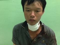 Ảnh bìa bài viết 347586