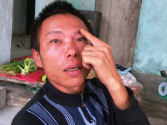 Ảnh bìa bài viết 350644