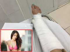 Ảnh bìa bài viết 354589