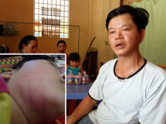 Ảnh bìa bài viết 355136