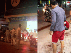 Ảnh bìa bài viết 359320