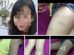Ảnh bìa bài viết 361843