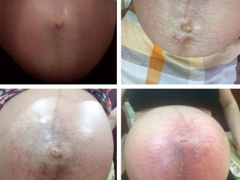 Ảnh bìa bài viết 362251