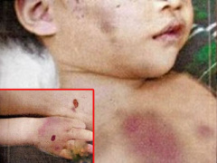 Ảnh bìa bài viết 363000