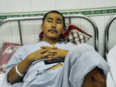 Ảnh bìa bài viết 364103