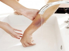 Ảnh bìa bài viết 364870