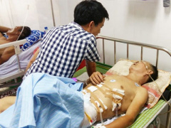 Ảnh bìa bài viết 366123