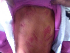 Ảnh bìa bài viết 366609