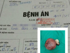 Ảnh bìa bài viết 367992
