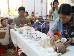 Ảnh bìa bài viết 369261