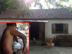 Ảnh bìa bài viết 369523