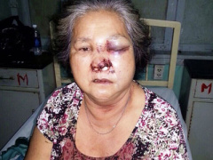 Ảnh bìa bài viết 369513