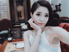 Ảnh bìa bài viết 369988