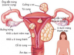 Ảnh bìa bài viết 370539