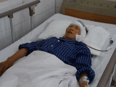 Ảnh bìa bài viết 371122