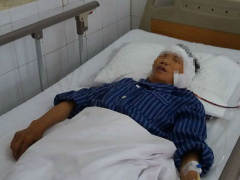 Ảnh bìa bài viết 371280