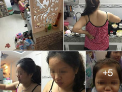Ảnh bìa bài viết 374335