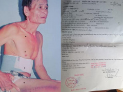 Ảnh bìa bài viết 382574