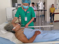 Ảnh bìa bài viết 384232