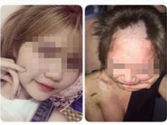 Ảnh bìa bài viết 384437