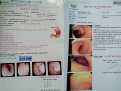 Ảnh bìa bài viết 384750