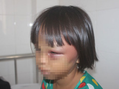 Ảnh bìa bài viết 385357