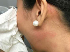 Ảnh bìa bài viết 385492