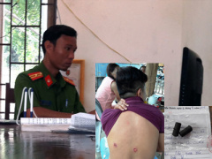 Ảnh bìa bài viết 387014