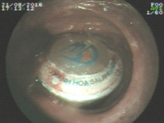 Ảnh bìa bài viết 387388