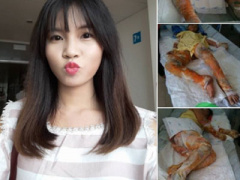 Ảnh bìa bài viết 392968
