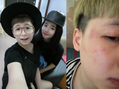 Ảnh bìa bài viết 394814