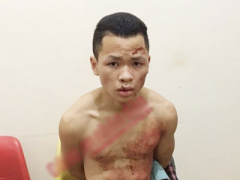 Ảnh bìa bài viết 398139