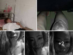 Ảnh bìa bài viết 398366