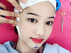 Ảnh bìa bài viết 398356