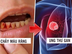 Ảnh bìa bài viết 399262
