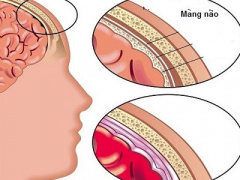 Ảnh bìa bài viết 405123