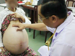 Ảnh bìa bài viết 406369