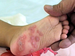 Ảnh bìa bài viết 409429