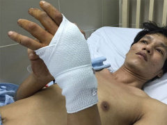 Ảnh bìa bài viết 410452