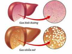 Ảnh bìa bài viết 410625