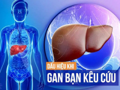 Ảnh bìa bài viết 412510